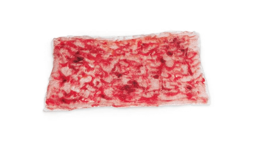 Simulierte Verbrennungen 2. Grades (tief) - Erler - Zimmer